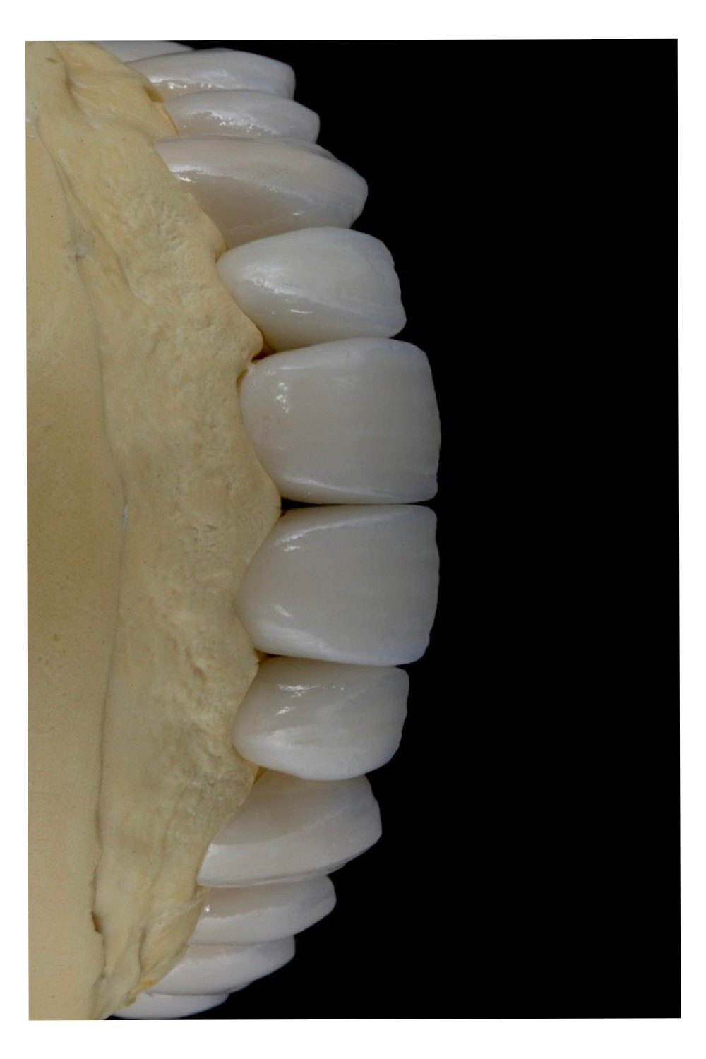 Estética dental