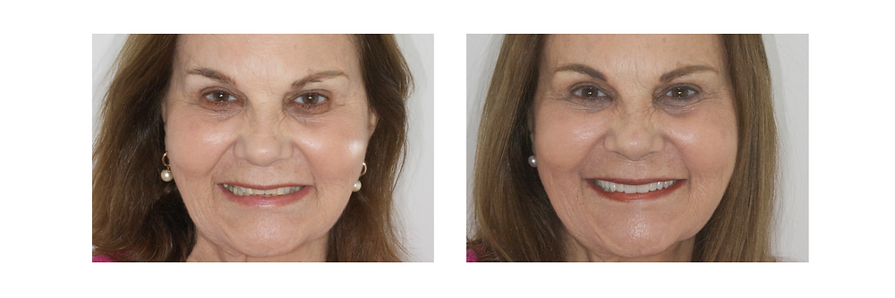 Estética dental