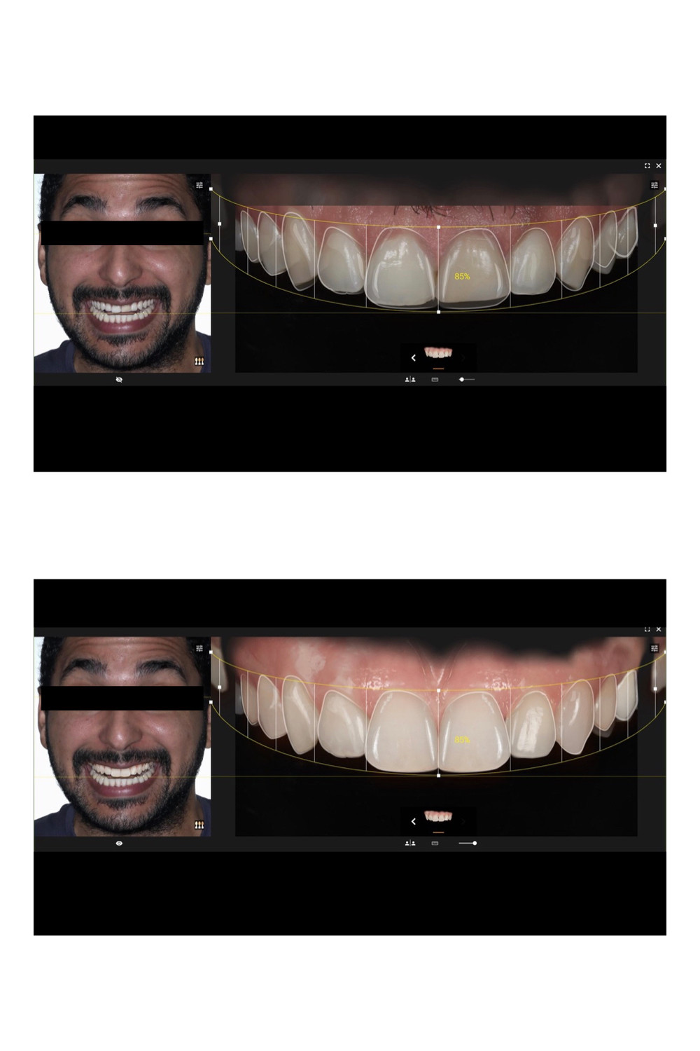 Antes e depois com planejamento digital.