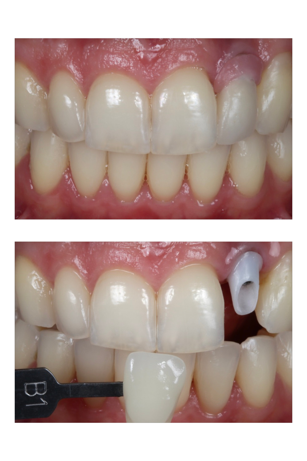 Antes e depois com planejamento digital.