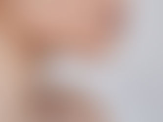 Acne is the most common skin condition in the United States, affecting millions of people of all ages