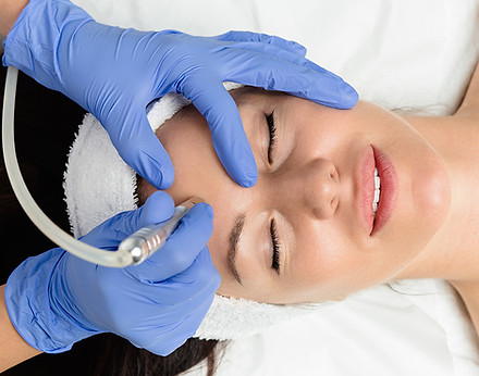 microdermabrasion-treatment.jpg