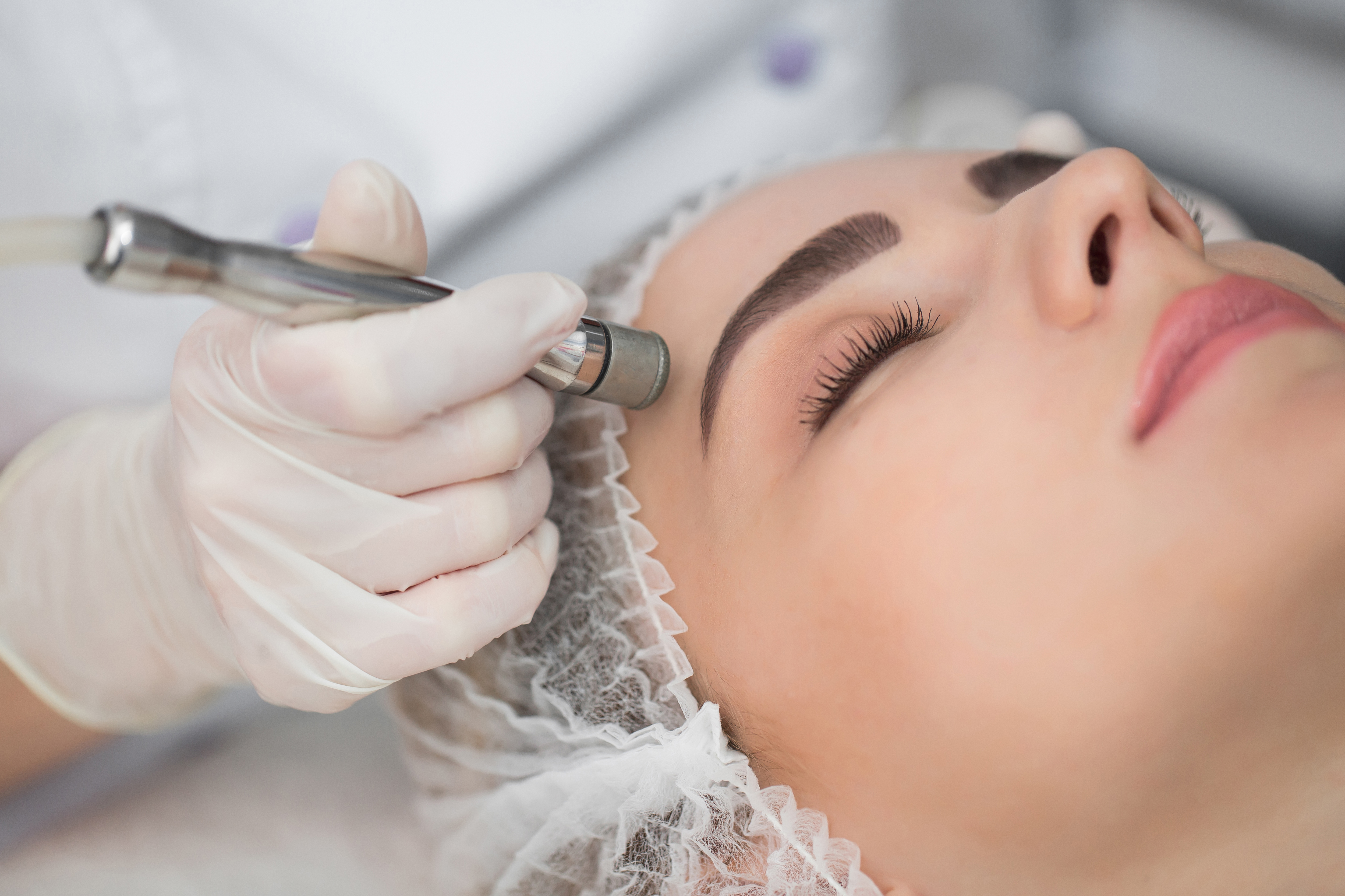 Client receiving skin needling treatment as part of the Essential Needling Package at DRML Skin Clinic in Winston Hills.