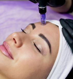 Microneedling