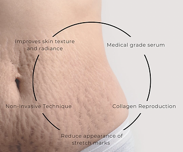 Medical grade, Collagen, Reduce stretch marks
