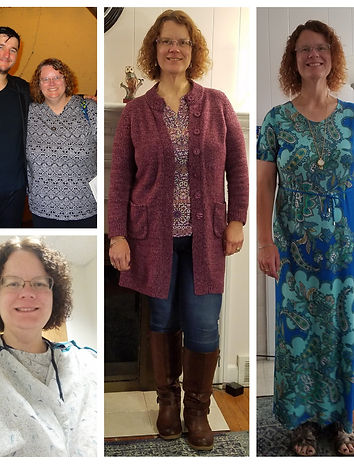 before and after weight loss surgery pics.jpg