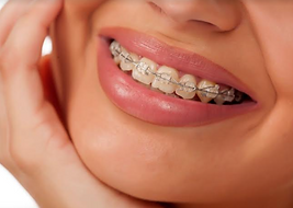 Orotodontia Dra Fátima Pimentel.png