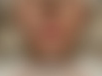 Les proportions des lèvres