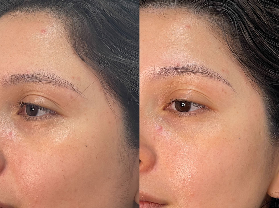 B&A MESOWORKS FACIAL