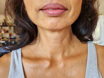Thyroid testimonial 1.jpg