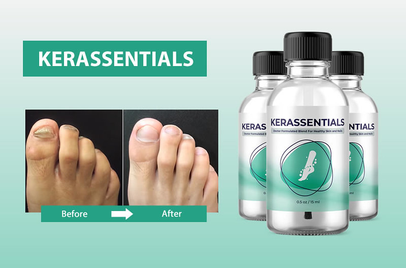 Kerassentials