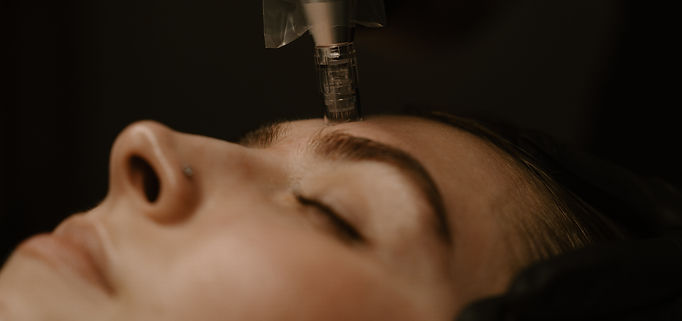 An esthetician performing CIT microneedling with a needle cartridge pen at Elevate in Eagle, Idaho.