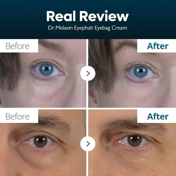 Thumbnail: Dr. Melaxin Eyephalt eye bags cream