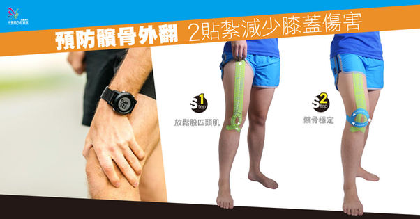 預防髕骨外翻 2貼紮減少膝蓋傷害
