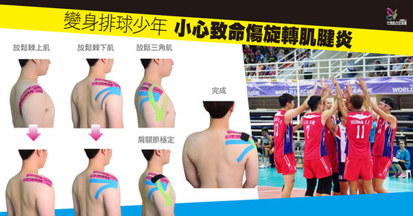 變身排球少年 5招預防致命傷旋轉肌腱炎