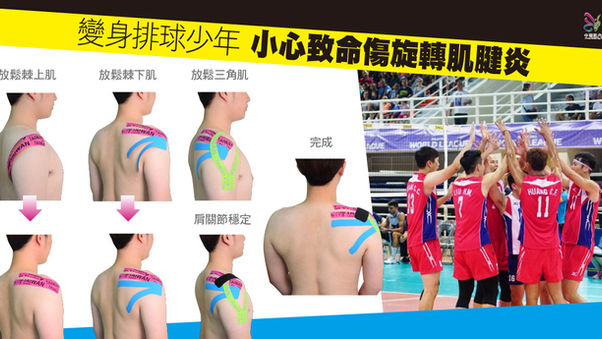 變身排球少年 5招預防致命傷旋轉肌腱炎