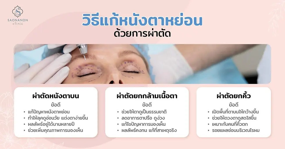 วิธีแก้หนังตาหย่อนด้วยการผ่าตัด