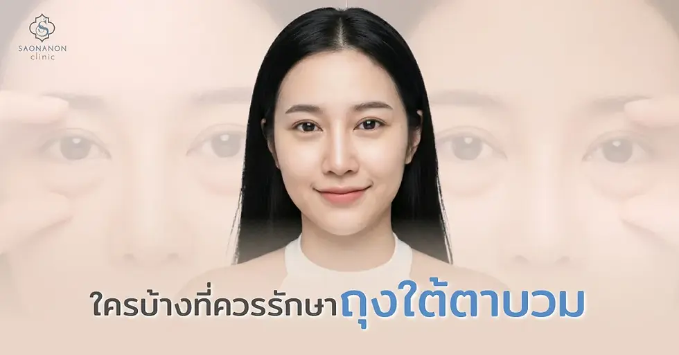 ใครบ้างที่ควรรักษาถุงใต้ตาบวม