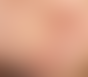 Що не день то прищ