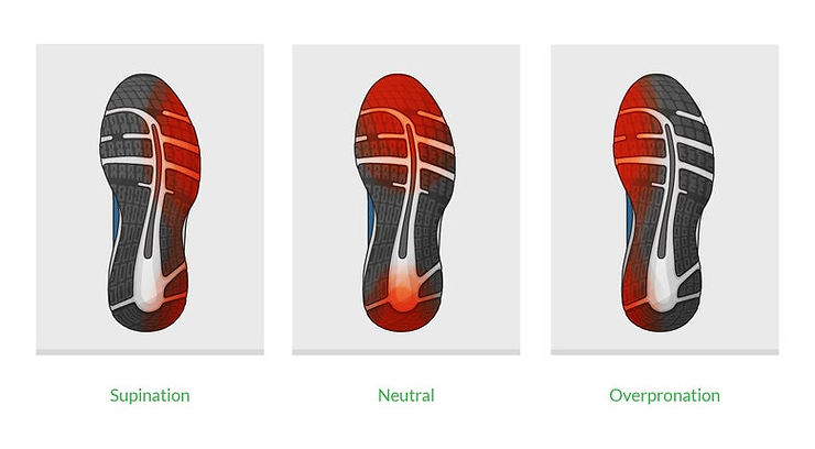 Foot Pronation and shoe wear and tear in underpronation and overpronation