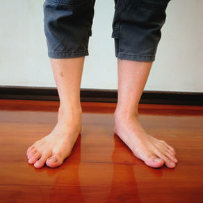 Why Shapecrunch Customized 3D Printed Insoles are the Ultimate Solution for Flat Feet Relief