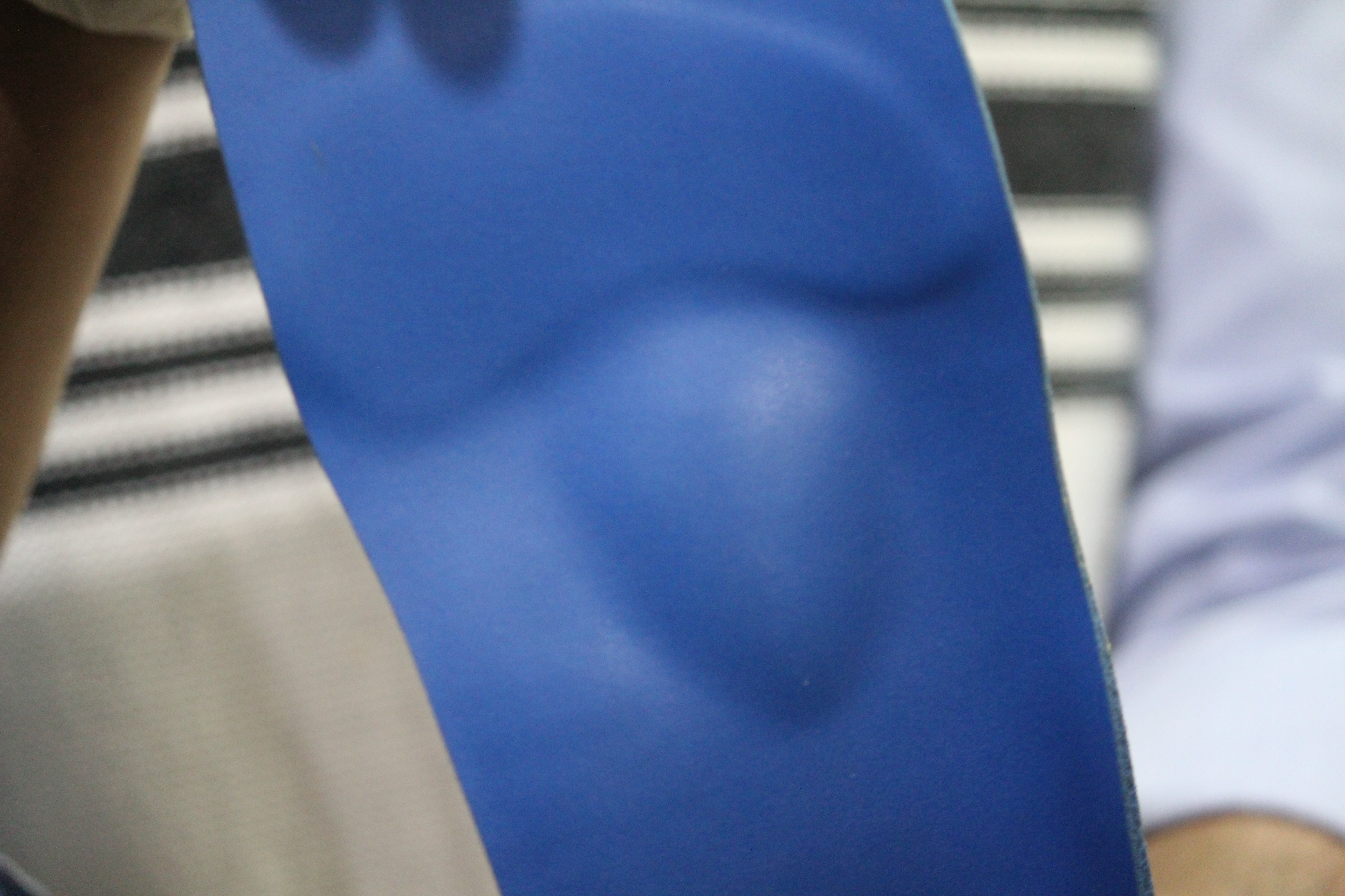 Metatarsal pad and offloading