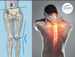 Can overpronation or a flat foot lead to back pain?