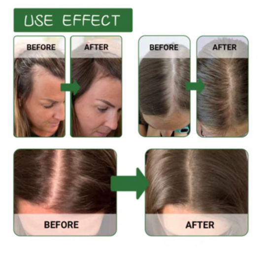 Thumbnail: Batana Oil 100% Pure