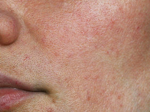 Rough & Uneven Texture.jpg
