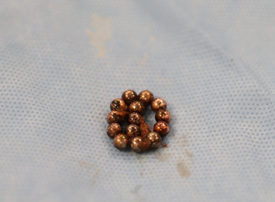 The magnetic beads - Photography: Rambam HCC