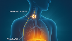 Human torso with glowing diaphragm and phrenic nerve from C4—Dopps Chiropractic, Overland Park KS, deep-breathing aid.