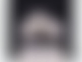 Porcelain Veneers Displayed