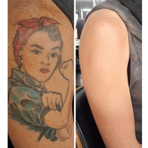 Tattoo Cover-Up Transformations
