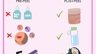 "Maximizing the Benefits: Pre and Post Procedure Tips for Chemical Peels" 