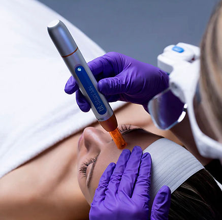 nanoneedling bastrop tx skincare blog facial