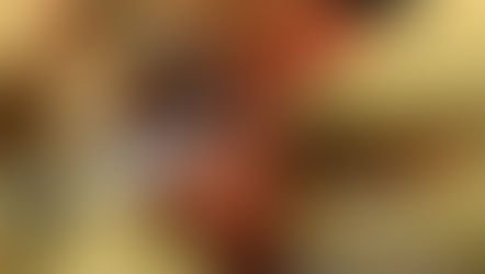 Cirugía de la mano y microcirugía