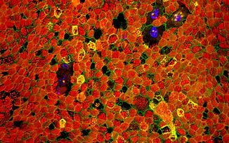 Image of lung cells with staining