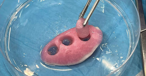 Precision-cut lung slices technique performed on a mouse lung in a petri dish