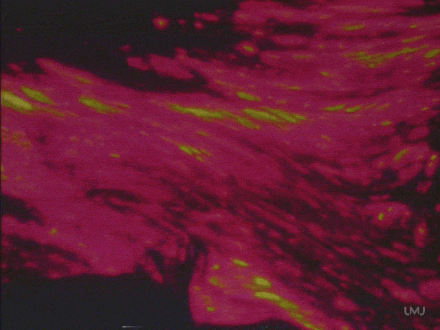original_81bbe3b68a7bf9ae1ce6cf8c154a5251 (1).gif