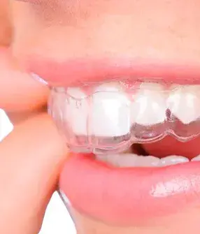 Dra Amanada Moreira - Dentista no Tatuapé especialista em ortodontia e alinhadores invisíveis