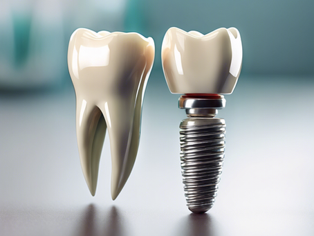 Advanced Dental Implants: Enhancing Smiles at Sudarshan Clinic