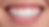 a close-up of a smiling mouth full of straight teeth with little sparkles indicating extra shiny teeth