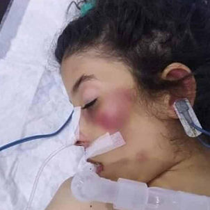 سوري يضرب طفلته حتى الموت