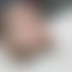 "الأمير النائم" يحرك يده بعد 15 سنة من الغيبوبة