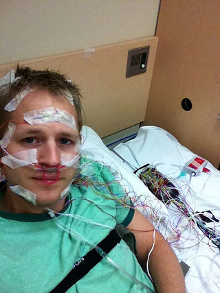 The Polysomnography machine