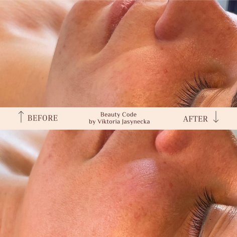 Straffere und hellere Haut nach Kobido-Massage