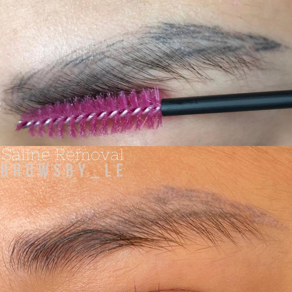 Eyebrow tattoo removal process