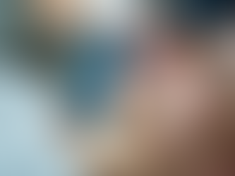 Improve Skin Health with Microneedling Benefits