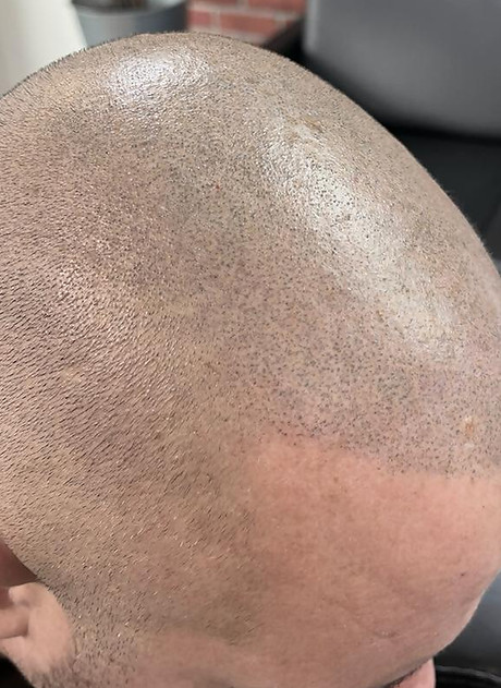 Head after treatment