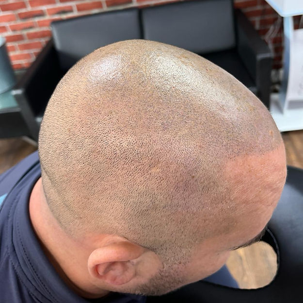 Man Part way through treatment